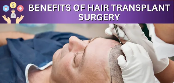 The Benefits of Hair Transplant Surgery