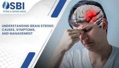 Understanding Brain Stroke: Causes, Symptoms, and Management