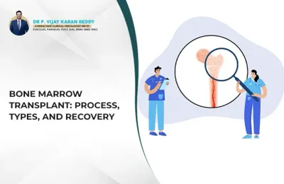 Bone Marrow Transplant: Process, Types, and Recovery