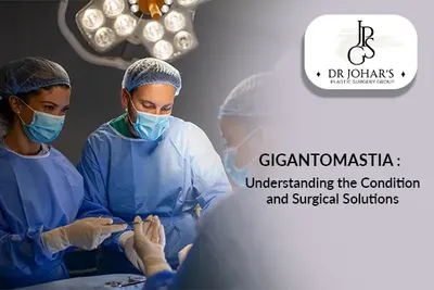 Gigantomastia: Understanding the Condition and Surgical Solutions