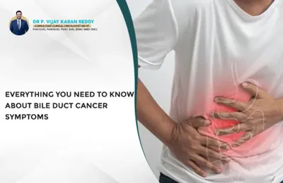 Everything You Need to Know About Bile Duct Cancer Symptoms