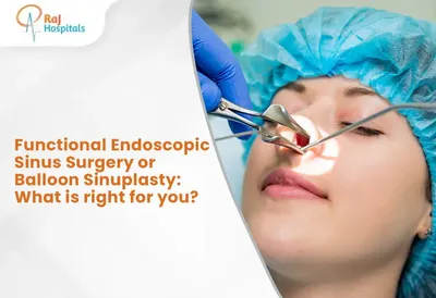 Functional Endoscopic Sinus Surgery or Balloon Sinuplasty: What is right for you?