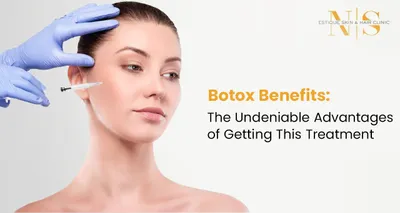 Botox Benefits: The Undeniable Advantages of Getting This Treatment