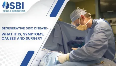 Degenerative Disc Disease - What It Is, Symptoms, Causes and Surgery