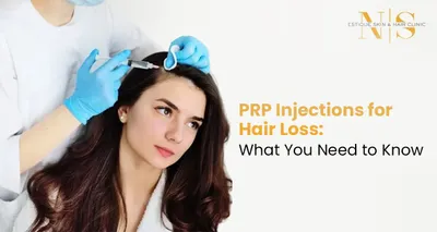 PRP Injections for Hair Loss: What You Need to Know