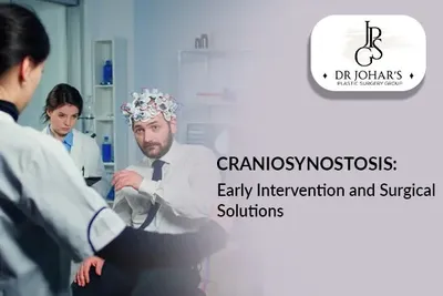 Craniosynostosis: Early Intervention and Surgical Solutions