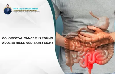 Colorectal Cancer in Young Adults: Risks and Early Signs