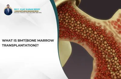 What is BMT(Bone Marrow Transplantation)?