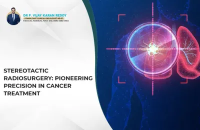 Stereotactic Radiosurgery: Pioneering Precision in Cancer Treatment