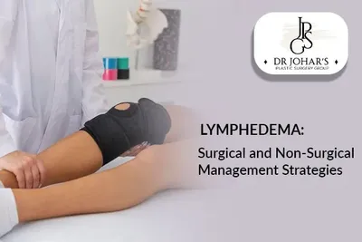 Lymphedema: Surgical and Non-Surgical Management Strategies