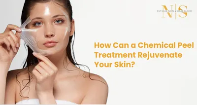 How Can a Chemical Peel Treatment Rejuvenate Your Skin?