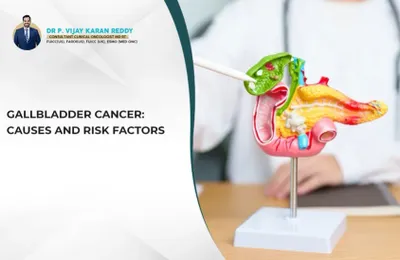 Gallbladder Cancer: Causes and Risk Factors