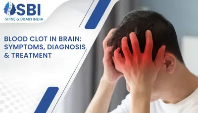 Blood Clot in Brain: Symptoms, Diagnosis & Treatment