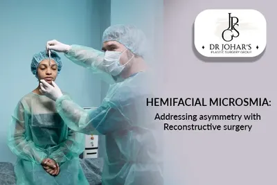 Hemifacial Microsomia: Addressing Asymmetry with Reconstructive Surgery