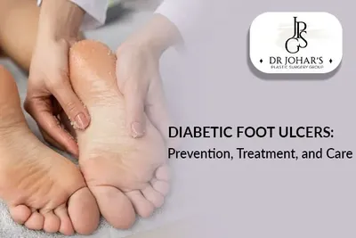 Diabetic Food Ulcers: Prevention, Treatment, and Care