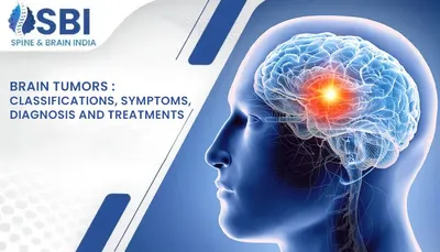 Brain Tumors - Classifications, Symptoms, Diagnosis and Treatments
