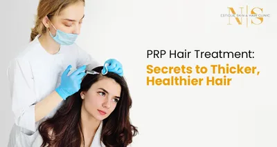 PRP Hair Treatment: Secrets to Thicker, Healthier Hair