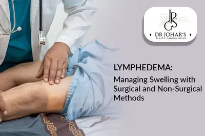 Lymphedema: Managing Swelling with Surgical and Non-Surgical Methods
