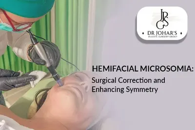Hemifacial Microsomia: Surgical Correction and Enhancing Symmetry