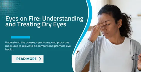 Eyes on Fire: Understanding and Treating Dry Eyes