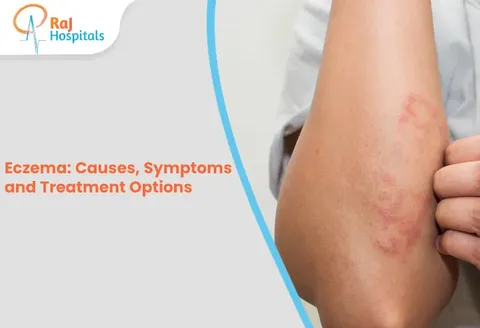Eczema: Causes, Symptoms and Treatment Options