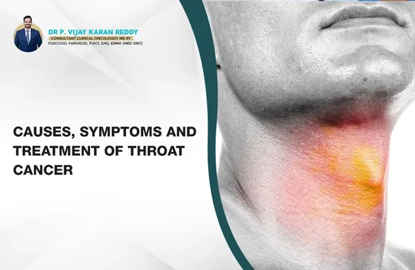 Causes, Symptoms and Treatment of Throat Cancer