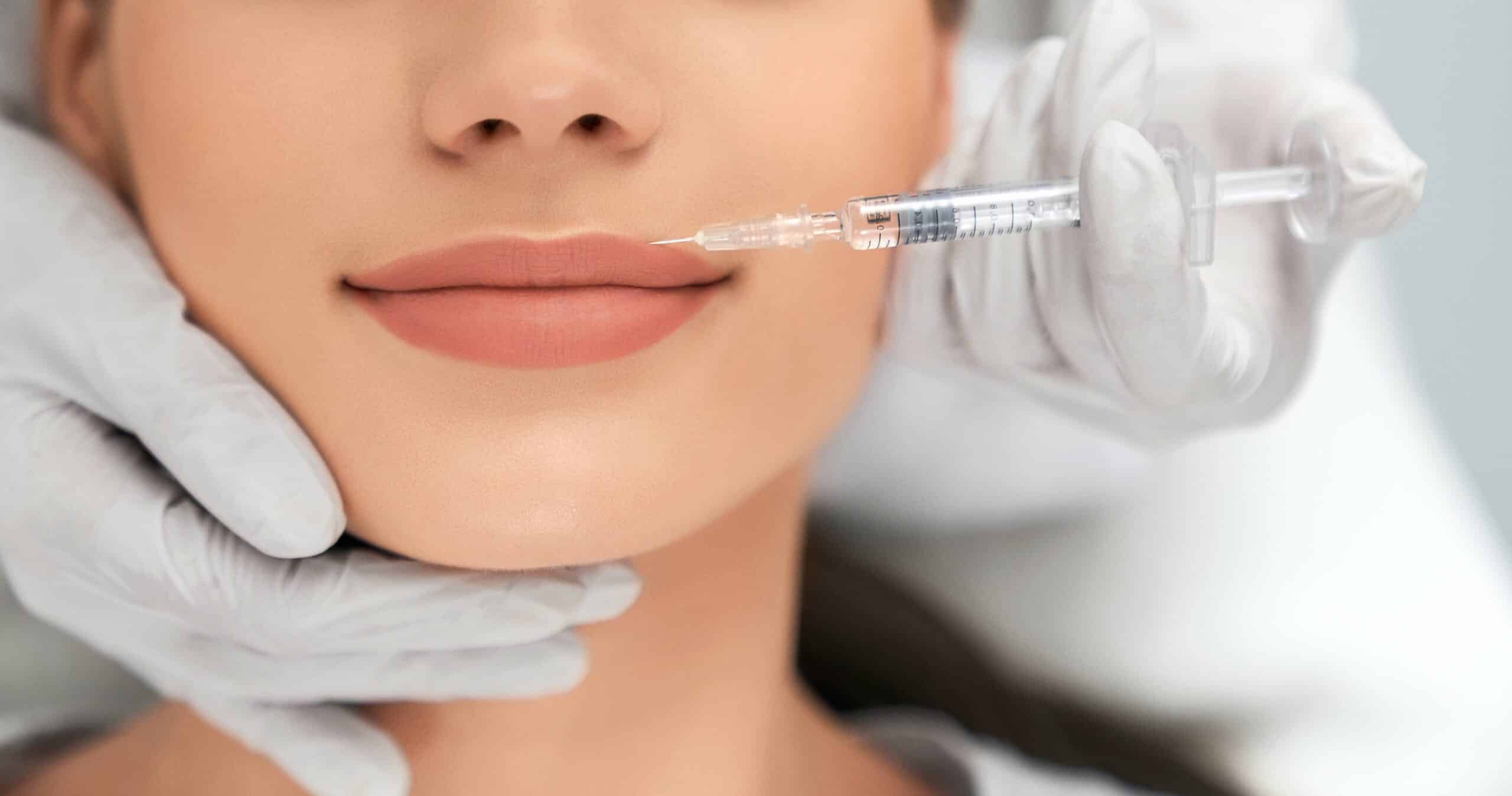 Lip fillers 101: What to expect during a lip filler procedure