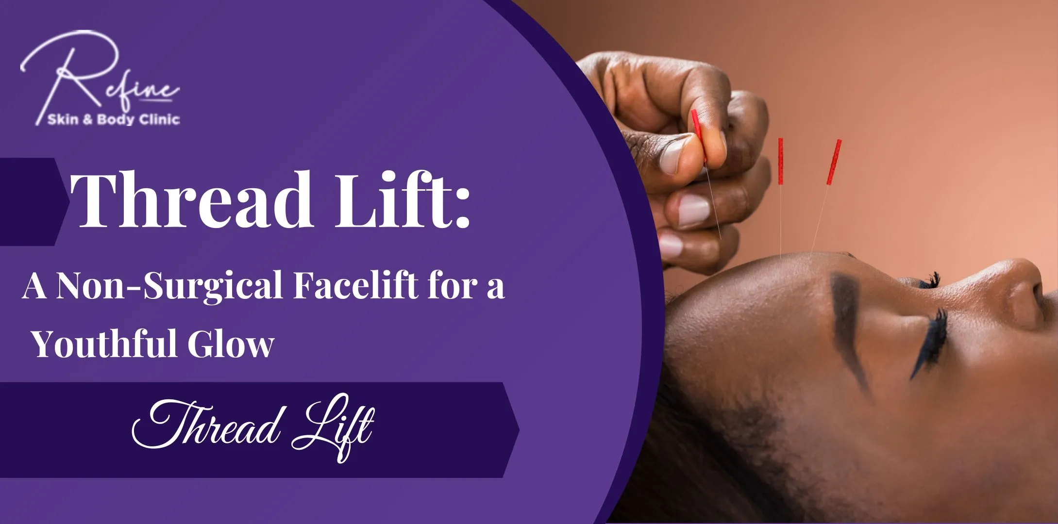 Thread Lift: A Non-Surgical Facelift for a Youthful Glow