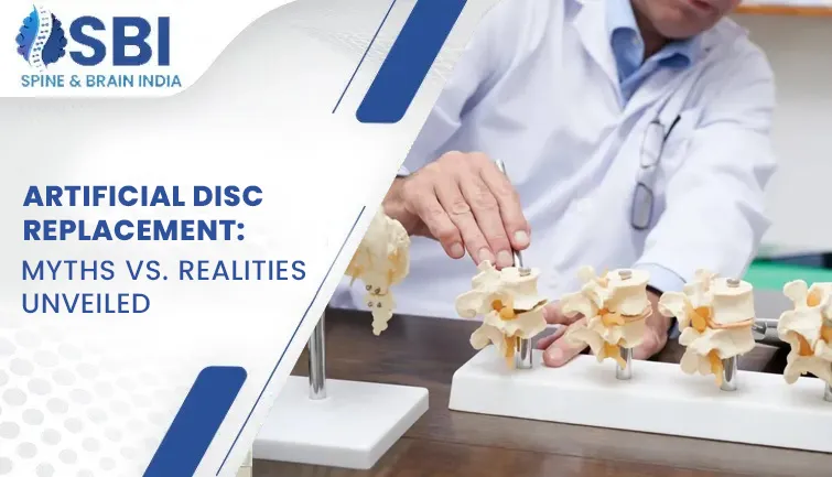 Artificial Disc Replacement: Myths vs. Realities Unveiled