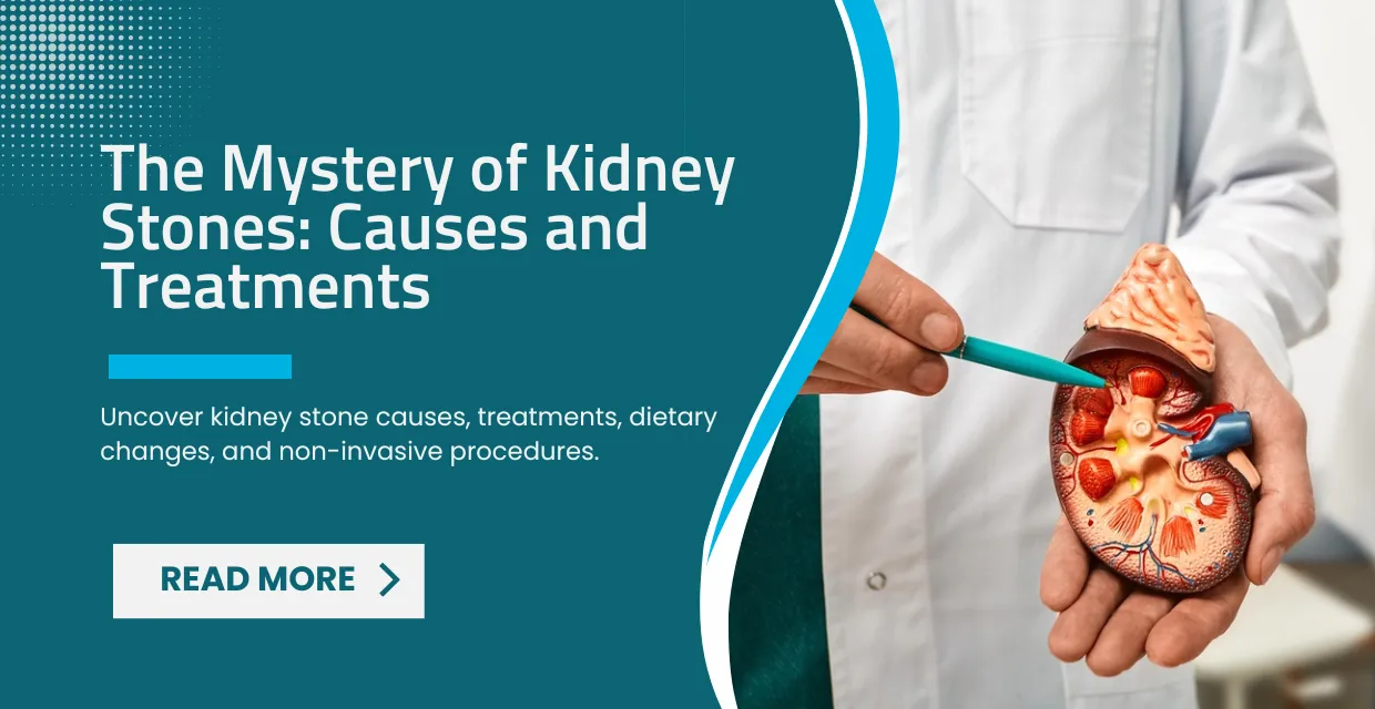 The Mystery of Kidney Stones: Causes and Treatments