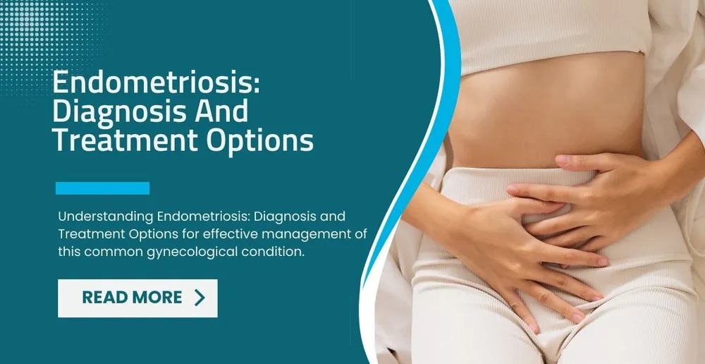 Endometriosis-Diagnosis And Treatment Options