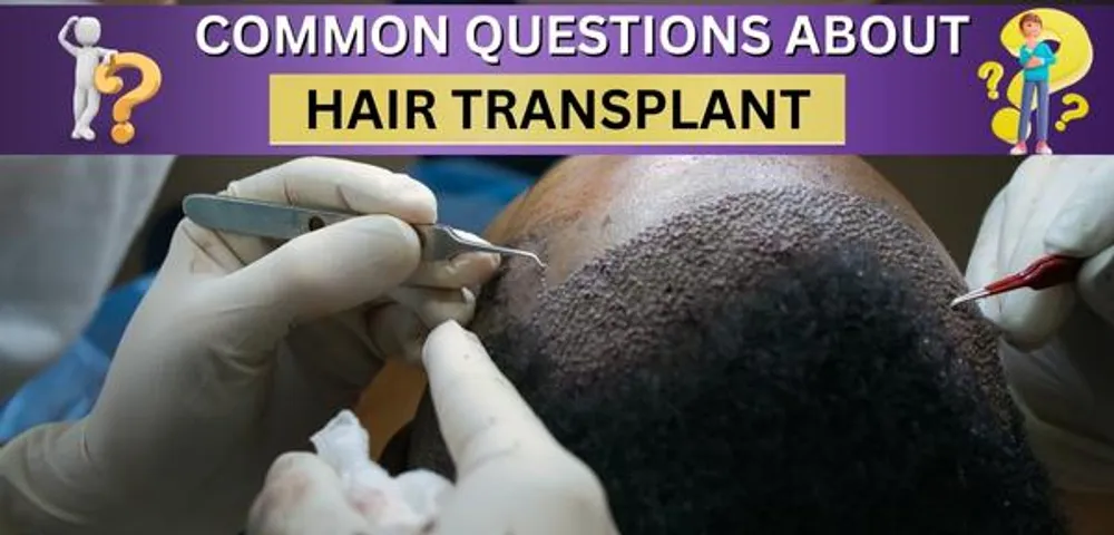 Hair Transplant FAQ: Common Questions and Answers