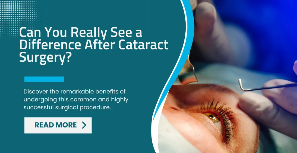 Can You Really See a Difference After Cataract Surgery?