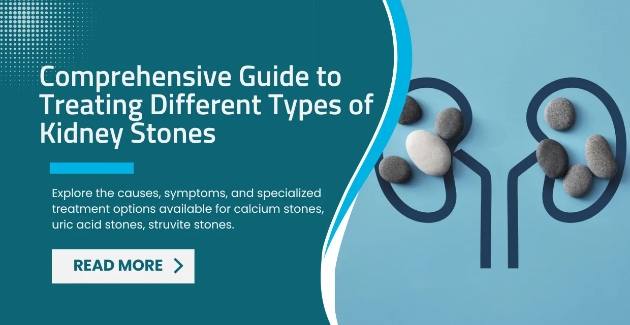 Comprehensive Guide to Treating Different Types of Kidney Stones