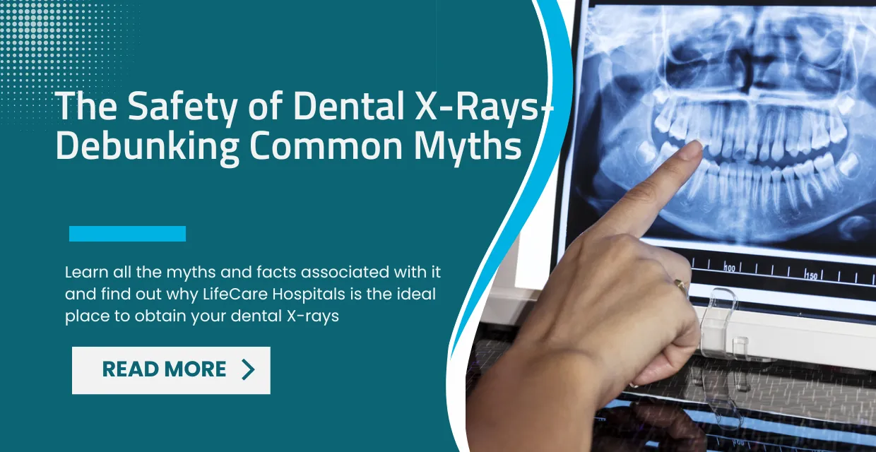 The Safety of Dental X-Rays-Debunking Common Myths